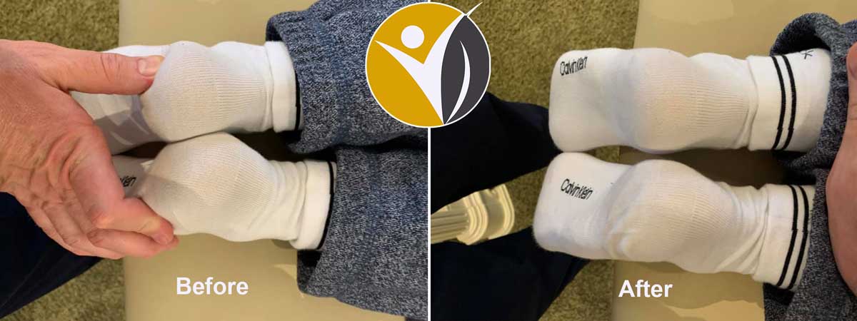 Light Body Therapy Clinic Osteopathy before after